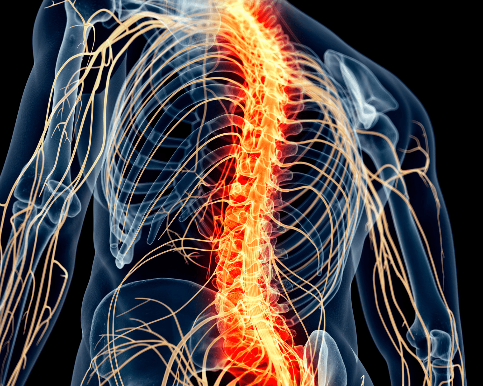 Review concludes SCS benefits do not outweigh associated risks and costs in low back pain